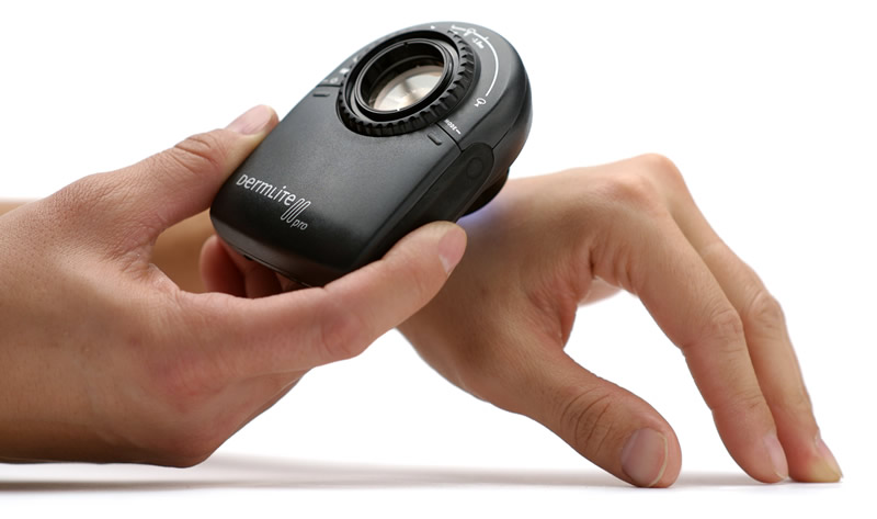  DermLite II Pro